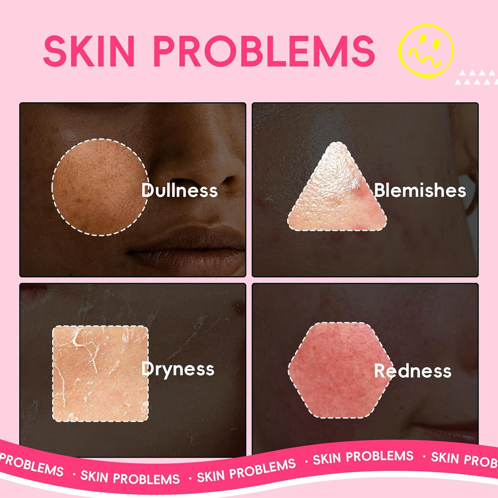Watermelon & Niacinamide Skincare Set for Women Teens Girls, 5PCS