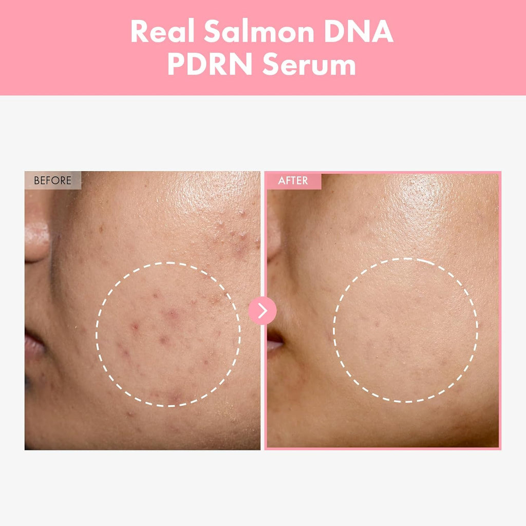 Pink Peptide 12 PDRN Serum for Firming & Glass Skin, Skin Glow