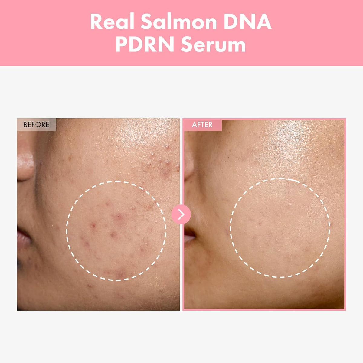 Pink Peptide 12 PDRN Serum for Firming & Glass Skin, Skin Glow
